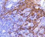 Cytokeratin 6 Antibody in Immunohistochemistry (Paraffin) (IHC (P))