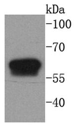 Cytokeratin 6 Antibody in Western Blot (WB)