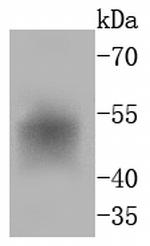 FosB Antibody in Western Blot (WB)