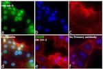 Caspase 6 p18 Antibody in Immunocytochemistry (ICC/IF)