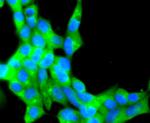 CD81 Antibody in Immunocytochemistry (ICC/IF)