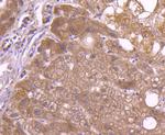 CD81 Antibody in Immunohistochemistry (Paraffin) (IHC (P))