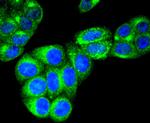 RAB7A Antibody in Immunocytochemistry (ICC/IF)