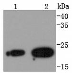 RAB7A Antibody in Western Blot (WB)