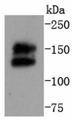 RET Antibody in Western Blot (WB)