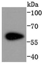 CDK8 Antibody in Western Blot (WB)