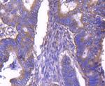 ARF1 Antibody in Immunohistochemistry (Paraffin) (IHC (P))