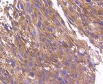 ARF1 Antibody in Immunohistochemistry (Paraffin) (IHC (P))