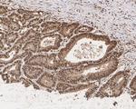 Cyclin E Antibody in Immunohistochemistry (Paraffin) (IHC (P))