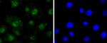 RelB Antibody in Immunocytochemistry (ICC/IF)