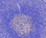 RelB Antibody in Immunohistochemistry (Paraffin) (IHC (P))