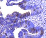 Cyclin A2 Antibody in Immunohistochemistry (Paraffin) (IHC (P))