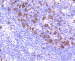 Cyclin A2 Antibody in Immunohistochemistry (Paraffin) (IHC (P))