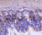 Cyclin A2 Antibody in Immunohistochemistry (Paraffin) (IHC (P))