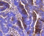 PDPK1 Antibody in Immunohistochemistry (Paraffin) (IHC (P))