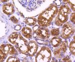 PDPK1 Antibody in Immunohistochemistry (Paraffin) (IHC (P))