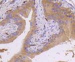 MKK7 Antibody in Immunohistochemistry (Paraffin) (IHC (P))