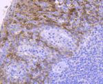 14-3-3 sigma Antibody in Immunohistochemistry (Paraffin) (IHC (P))