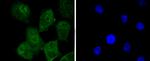 TRIM28 Antibody in Immunocytochemistry (ICC/IF)