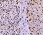 TRIM28 Antibody in Immunohistochemistry (Paraffin) (IHC (P))