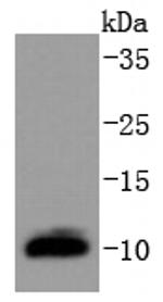 DYNLL1 Antibody in Western Blot (WB)