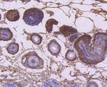 KRT9 Antibody in Immunohistochemistry (Paraffin) (IHC (P))