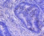 Cyclin A Antibody in Immunohistochemistry (Paraffin) (IHC (P))