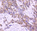 RON Antibody in Immunohistochemistry (Paraffin) (IHC (P))