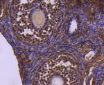 UBE1 Antibody in Immunohistochemistry (Paraffin) (IHC (P))