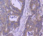 HSP105 Antibody in Immunohistochemistry (Paraffin) (IHC (P))