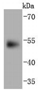 PAX6 Antibody in Western Blot (WB)