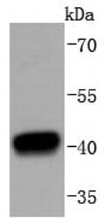 HDAC8 Antibody in Western Blot (WB)