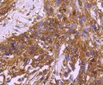 14-3-3 beta Antibody in Immunohistochemistry (Paraffin) (IHC (P))