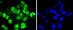 HDAC8 Antibody in Immunocytochemistry (ICC/IF)