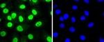 HDAC8 Antibody in Immunocytochemistry (ICC/IF)