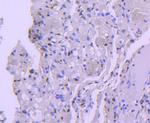 HDAC8 Antibody in Immunohistochemistry (Paraffin) (IHC (P))