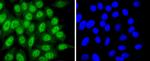 CDK7 Antibody in Immunocytochemistry (ICC/IF)