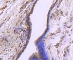 CDK7 Antibody in Immunohistochemistry (Paraffin) (IHC (P))