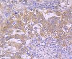 CDK7 Antibody in Immunohistochemistry (Paraffin) (IHC (P))