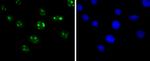 SIRT6 Antibody in Immunocytochemistry (ICC/IF)