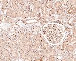 Phospho-c-Raf (Ser621) Antibody in Immunohistochemistry (Paraffin) (IHC (P))