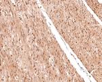 Phospho-c-Raf (Ser621) Antibody in Immunohistochemistry (Paraffin) (IHC (P))