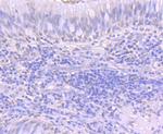 ATF1 Antibody in Immunohistochemistry (Paraffin) (IHC (P))