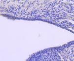 ATF1 Antibody in Immunohistochemistry (Paraffin) (IHC (P))