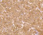 GLUT2 Antibody in Immunohistochemistry (Paraffin) (IHC (P))