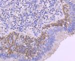 Phospho-RAC1/CDC42 (Ser71) Antibody in Immunohistochemistry (Paraffin) (IHC (P))