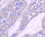 Phospho-RAC1/CDC42 (Ser71) Antibody in Immunohistochemistry (Paraffin) (IHC (P))