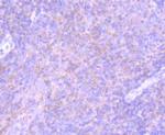 PD-L1 (CD274) Antibody in Immunohistochemistry (Paraffin) (IHC (P))