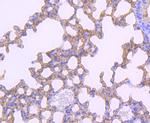 PD-L1 (CD274) Antibody in Immunohistochemistry (Paraffin) (IHC (P))