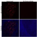 PD-L1 (CD274) Antibody in Immunohistochemistry (Paraffin) (IHC (P))